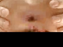 아시아 항문 Dagestan CD1