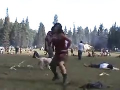 의 꿈:털이 armpits19